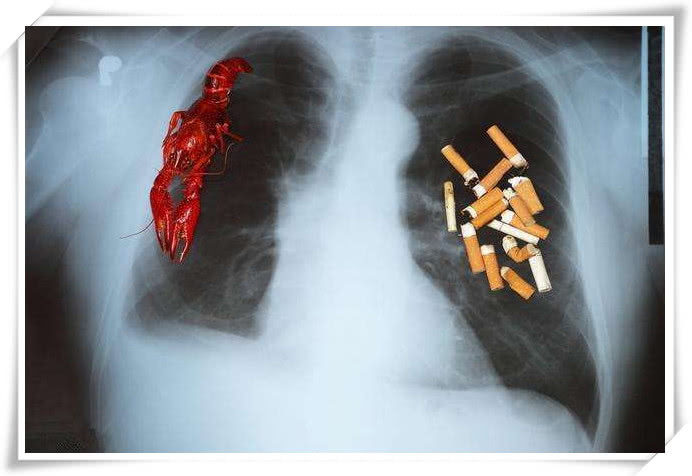 肺癌早期症状图片图片